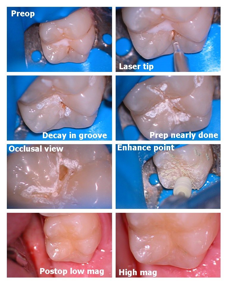 Microdental 2.jpg